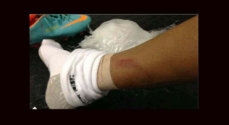 Neymar dio un show, pero cobro! mira el video Neymar dio un show, pero cobro! mira el video